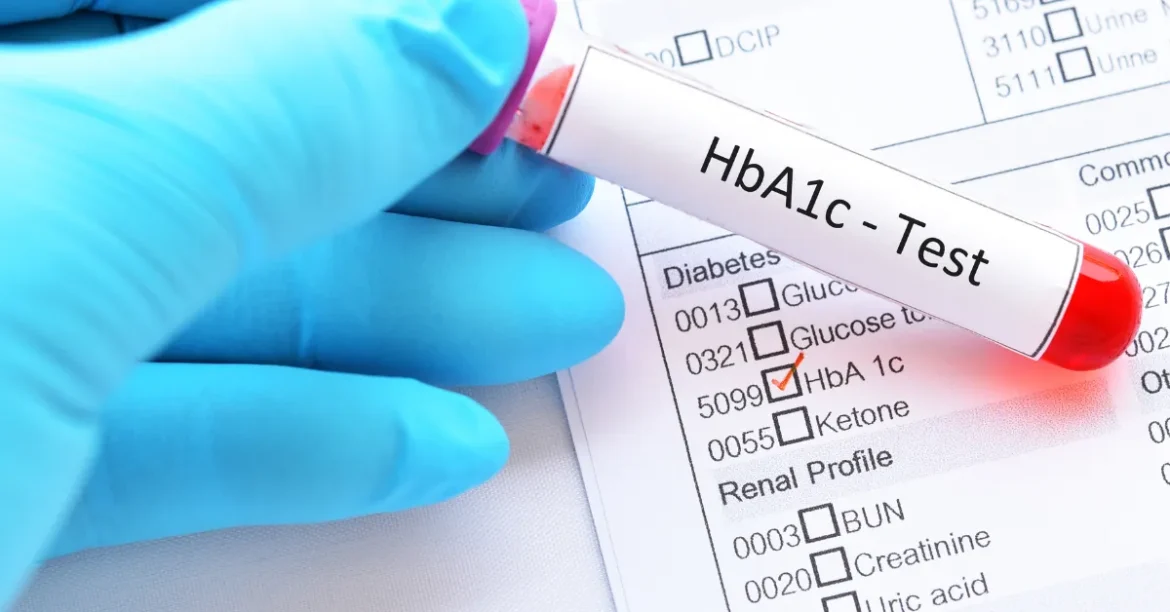 HbA1c Test: What It Measures