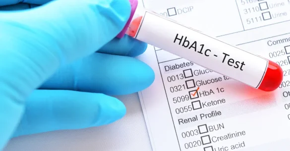 HbA1c Test: What It Measures